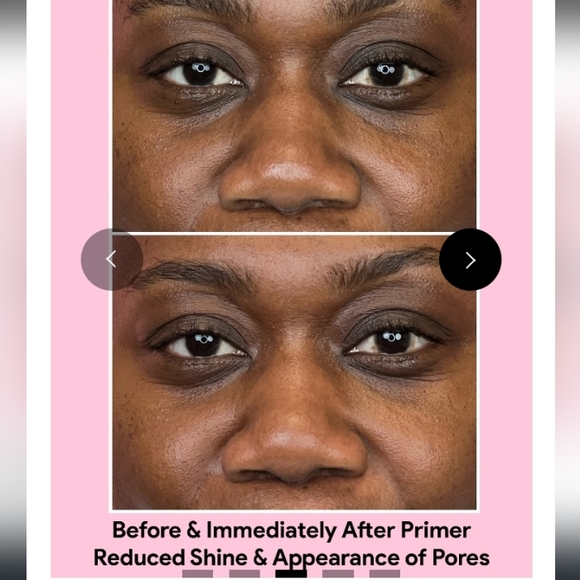 Jori Rx Acne Control Primer - Picture 2 of 5